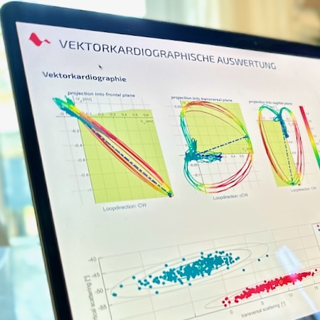 Cardisiographie-Untersuchung